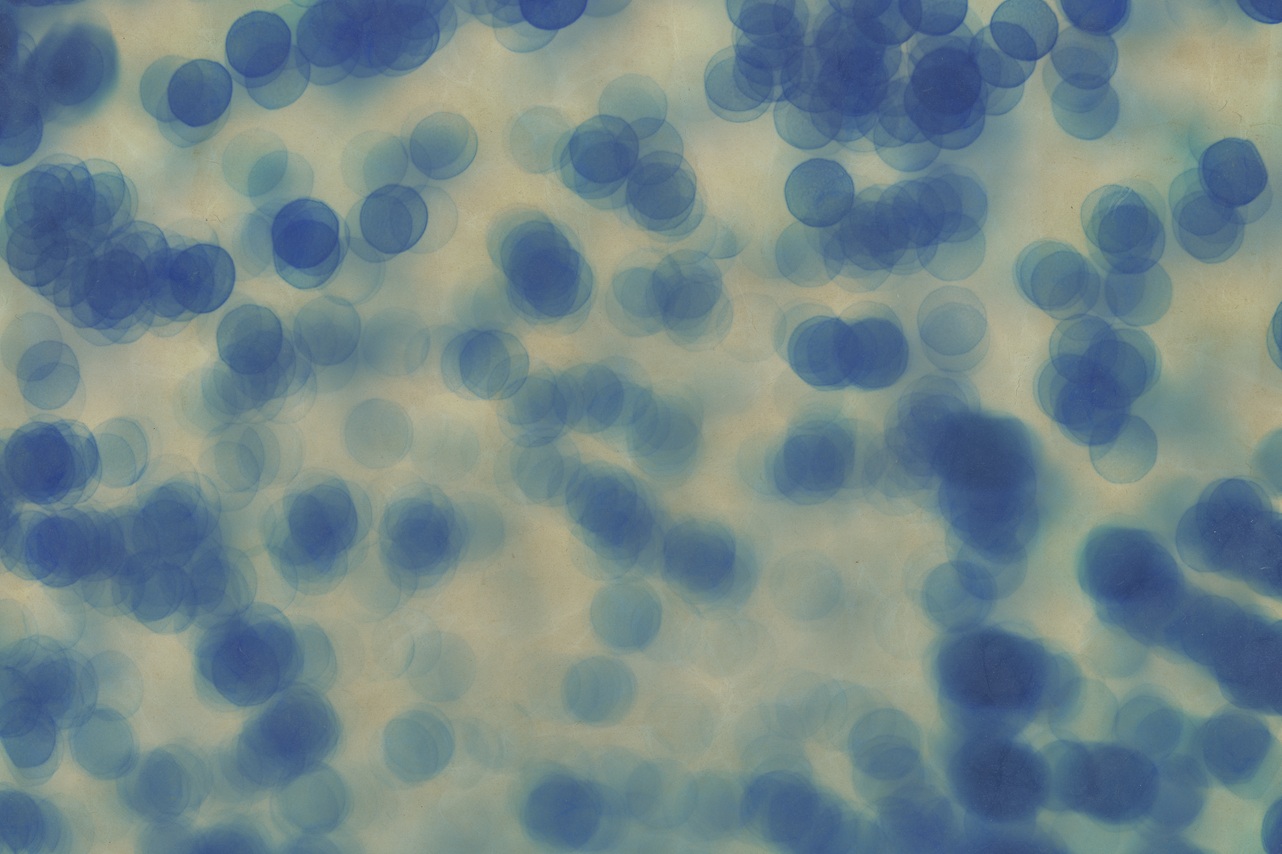 Actuación ante un brote de Legionella